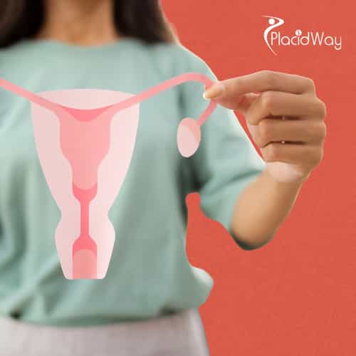 Ovarian Rejuvenation with Stem Cell Therapy in Guadalajara: Current Approaches and Clinical Considerations